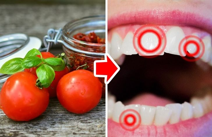 The Top 7 Foods That Severely Harm Your Teeth